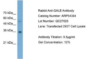WB Suggested Anti-GALE  Antibody Titration: 0.