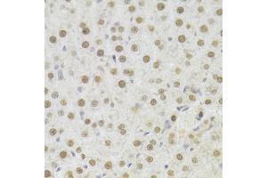 Immunohistochemistry of paraffin-embedded rat liver using HDGF Antibody (ABIN1876535) at dilution of 1:100 (40x lens). (HDGF 抗体)