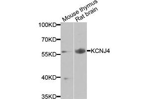 Western blot analysis of extracts of various cells, using KCNJ4 antibody.