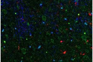 Image no. 1 for anti-Interleukin 11 (IL11) antibody (ABIN465009) (IL-11 抗体)