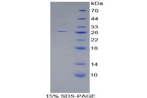 SDS-PAGE analysis of Human Nephrin Protein. (Nephrin 蛋白)