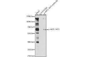 Immunoprecipitation analysis of 200 μg extracts of Jurkat cells, using 3 μg Phospho--S473 pAb (ABIN1513328, ABIN5664973, ABIN5664975 and ABIN6225474). (AKT1 抗体  (pSer473))