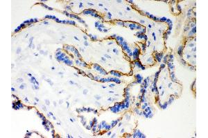 Immunohistochemistry (Paraffin-embedded Sections) (IHC (p)) image for anti-Cadherin 1, Type 1, E-Cadherin (Epithelial) (CDH1) (AA 286-703) antibody (ABIN3043808)