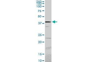 PSMC6 monoclonal antibody (M02), clone 2C4.