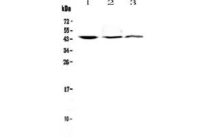 Western blot analysis of CD16 using anti-CD16 antibody . (FCGR3A 抗体  (AA 101-166))