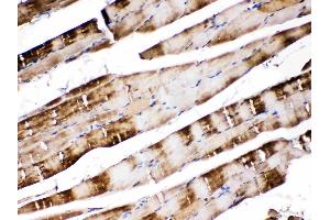 Immunohistochemistry (IHC) image for anti-Carbonic Anhydrase III (CA3) (AA 14-235) antibody (ABIN4886494)