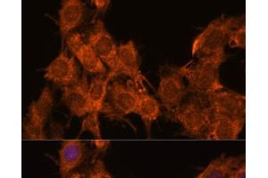 Immunofluorescence analysis of C6 cells using SNX15 Polyclonal Antibody at dilution of 1:100. (SNX15 抗体)