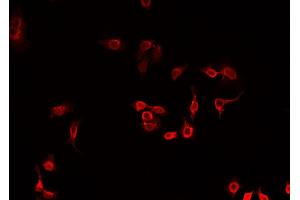 ABIN6269210 staining A549 cells by IF/ICC. (MARCKS 抗体  (Internal Region))
