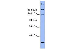 WB Suggested Anti-APOB Antibody Titration:  0. (APOB 抗体  (Middle Region))