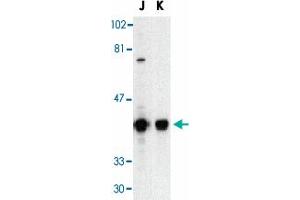 Western blot analysis of DFFB in Jurkat (J) and K-562 (K) whole cell lysate with DFFB polyclonal antibody  at 1 : 500 dilution. (DFFB 抗体  (AA 3-18))
