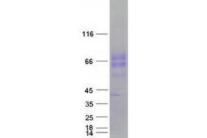 Western Blotting (WB) image for Ectonucleoside Triphosphate diphosphohydrolase 1 (ENTPD1) (Transcript Variant 1) protein (Myc-DYKDDDDK Tag) (ABIN2713698)