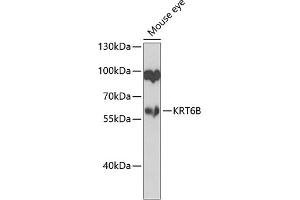 Western blot analysis of extracts of mouse eye, using KRT6B antibody (ABIN6129538, ABIN6143035, ABIN6143036 and ABIN6223626) at 1:1000 dilution. (Keratin 6B 抗体  (AA 1-280))