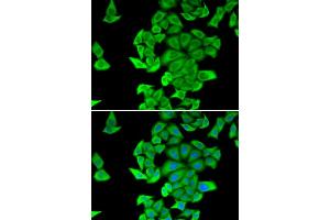 Immunofluorescence analysis of HeLa cells using SMYD2 antibody. (SMYD2A 抗体)