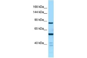 Western Blotting (WB) image for anti-CTD (Carboxy-terminal Domain, RNA Polymerase II, Polypeptide A) Phosphatase, Subunit 1 (CTDP1) (C-Term) antibody (ABIN2790245)