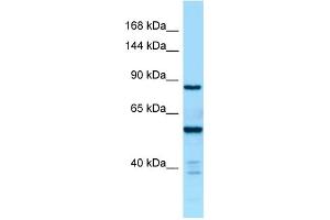 WB Suggested Anti-CTDP1 Antibody Titration: 1. (CTDP1 抗体  (C-Term))