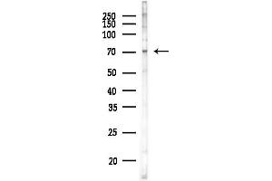 anti-Docking Protein 7 (DOK7) (C-Term) antibody