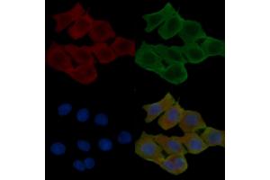 ABIN6257255 and ABIN6274428 staining Hela cells(24h of starvation treatment) by IF/ICC. (HIPK4 抗体  (C-Term))
