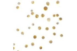 Immunohistochemistry (IHC) image for anti-B-Cell CLL/lymphoma 9-Like (BCL9L) (N-Term) antibody (ABIN1031268) (BCL9L 抗体  (N-Term))