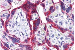 Human Placenta: Formalin-Fixed, Paraffin-Embedded (FFPE) (ATG9B 抗体  (C-Term))