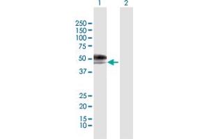 Western Blot analysis of IL13RA2 expression in transfected 293T cell line by IL13RA2 MaxPab polyclonal antibody. (IL13RA2 抗体  (AA 1-380))