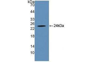 Western blot analysis of recombinant Human CRYaB. (CRYAB 抗体  (AA 1-175))