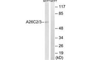 Western blot analysis of extracts from MCF-7 cells, using A26C2/3 Antibody. (A26C2/3 (AA 178-227) 抗体)