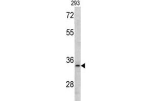 Western Blotting (WB) image for anti-DNA Segment, MCA1, Multiple CA Repeat 1 (MCA1) antibody (ABIN3002773) (MCA1 抗体)