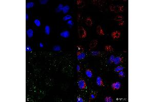Immunocytochemistry/Immunofluorescence analysis on permeabilized HCT116 cells using Mouse Anti-HSP70 Monoclonal Antibody, Clone 1H11: FITC conjugate  showing faint cell membrane and intracellular staining. (HSP70 抗体)