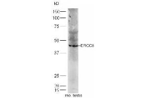 Western Blotting (WB) image for anti-Excision Repair Cross-Complementing Rodent Repair Deficiency, Complementation Group 8 (ERCC8) (AA 161-260) antibody (ABIN1713778)