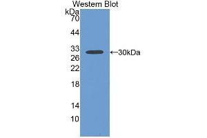 Western Blotting (WB) image for anti-Fibulin 1 (FBLN1) (AA 176-398) antibody (ABIN1175702) (Fibulin 1 抗体  (AA 176-398))
