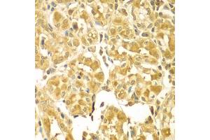 Immunohistochemistry of paraffin-embedded human gastric using SESN2 antibody (ABIN5975589) at dilution of 1/100 (40x lens). (Sestrin 2 抗体)