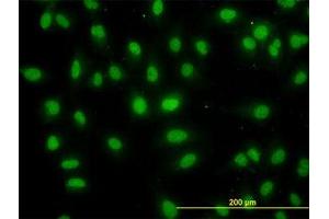 Image no. 5 for anti-DEAD (Asp-Glu-Ala-Asp) Box Polypeptide 56 (DDX56) (AA 450-548) antibody (ABIN599259) (DDX56 抗体  (AA 450-548))