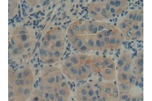 Detection of GBA in Human Liver Tissue using Polyclonal Antibody to Glucocerebrosidase (GBA) (GBA 抗体  (AA 117-214))