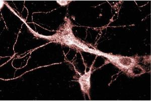 Rat Neurons (KIF3A 抗体  (AA 563-671))
