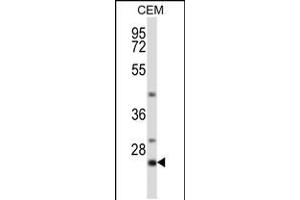 Western blot analysis in CEM cell line lysates (35ug/lane). (LIME 抗体  (C-Term))