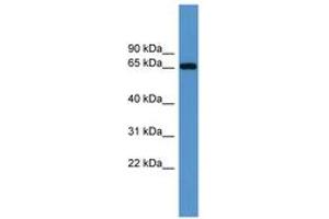 Image no. 1 for anti-Insulin-Like Growth Factor 2 mRNA Binding Protein 3 (IGF2BP3) (AA 161-210) antibody (ABIN6746192)