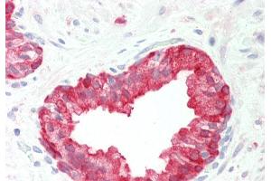 Rabbit Anti-PHGDH antibody Catalog Number: ARP54801 Formalin Fixed Paraffin Embedded Tissue: Human Prostate Primary antibody Concentration: 1:100 Secondary Antibody: Donkey anti-Rabbit-Cy3 Secondary Antibody Concentration: 1:200 Magnification: 20x Exposure Time: 0. (PHGDH 抗体  (Middle Region))