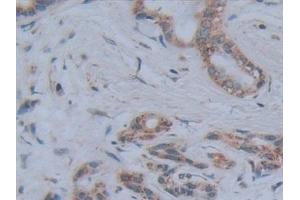 Detection of ALPL in Human Pancreas Tissue using Polyclonal Antibody to Alkaline Phosphatase, Tissue-nonspecific (ALPL) (ALPL 抗体  (AA 18-335))