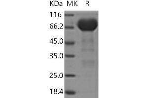 Western Blotting (WB) image for EPH Receptor A3 (EPHA3) (Active) protein (His tag) (ABIN7195524)