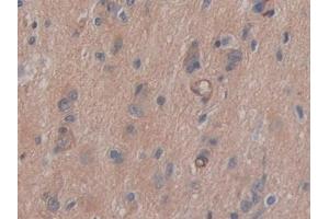 Immunohistochemistry (IHC) image for anti-Basigin (Ok Blood Group) (BSG) (AA 79-280) antibody (ABIN7433759)