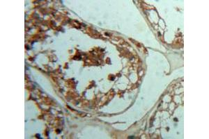 Used in DAB staining on fromalin fixed paraffin-embedded Testis tissue (PTH2R 抗体  (AA 27-145))