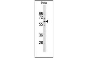Western blot analysis of Glypican-1 / GPC1Antibody (N-term) in Hela cell line lysates (35ug/lane). (GPC1 抗体  (N-Term))