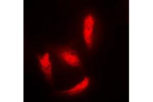 Immunofluorescent analysis of Histone Deacetylase 5 staining in HeLa cells. (HDAC5 抗体  (Center))