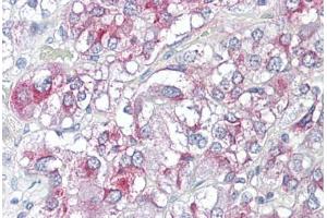 Immunohistochemistry (IHC) image for anti-Potassium Voltage-Gated Channel, Subfamily H (Eag-Related), Member 3 (Kcnh3) (AA 684-733) antibody (ABIN6749711)