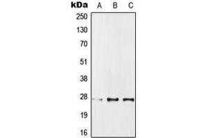 Western blot analysis of IPP1 expression in MCF7 (A), SP2/0 (B), PC12 (C) whole cell lysates. (PPP1R1A 抗体  (Center))
