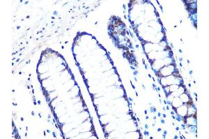 Immunohistochemistry (IHC) image for anti-Stratifin (SFN) antibody (ABIN7270602)