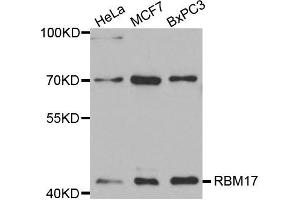 Western Blotting (WB) image for anti-RNA Binding Motif Protein 17 (RBM17) antibody (ABIN1875451) (RBM17 抗体)