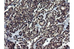 Image no. 4 for anti-NIMA (Never In Mitosis Gene A)-Related Kinase 11 (NEK11) antibody (ABIN1499682)