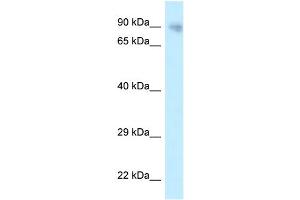 WB Suggested Anti-PPP6R3 Antibody Titration: 1. (PPP6R3 抗体  (N-Term))