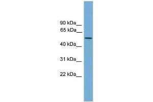 Human NCI-H226; WB Suggested Anti-EFCAB3 Antibody Titration: 0. (EFCAB3 抗体  (N-Term))
